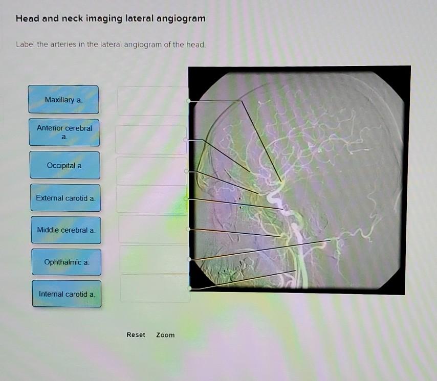 Head and neck imaging lateral angiogram Label the arteries in the lateral angiogram of the head. Maxillary a Anterior cerebra