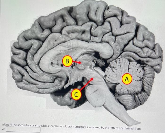 Solved B A C Identify the secondary brain vesicles that the | Chegg.com