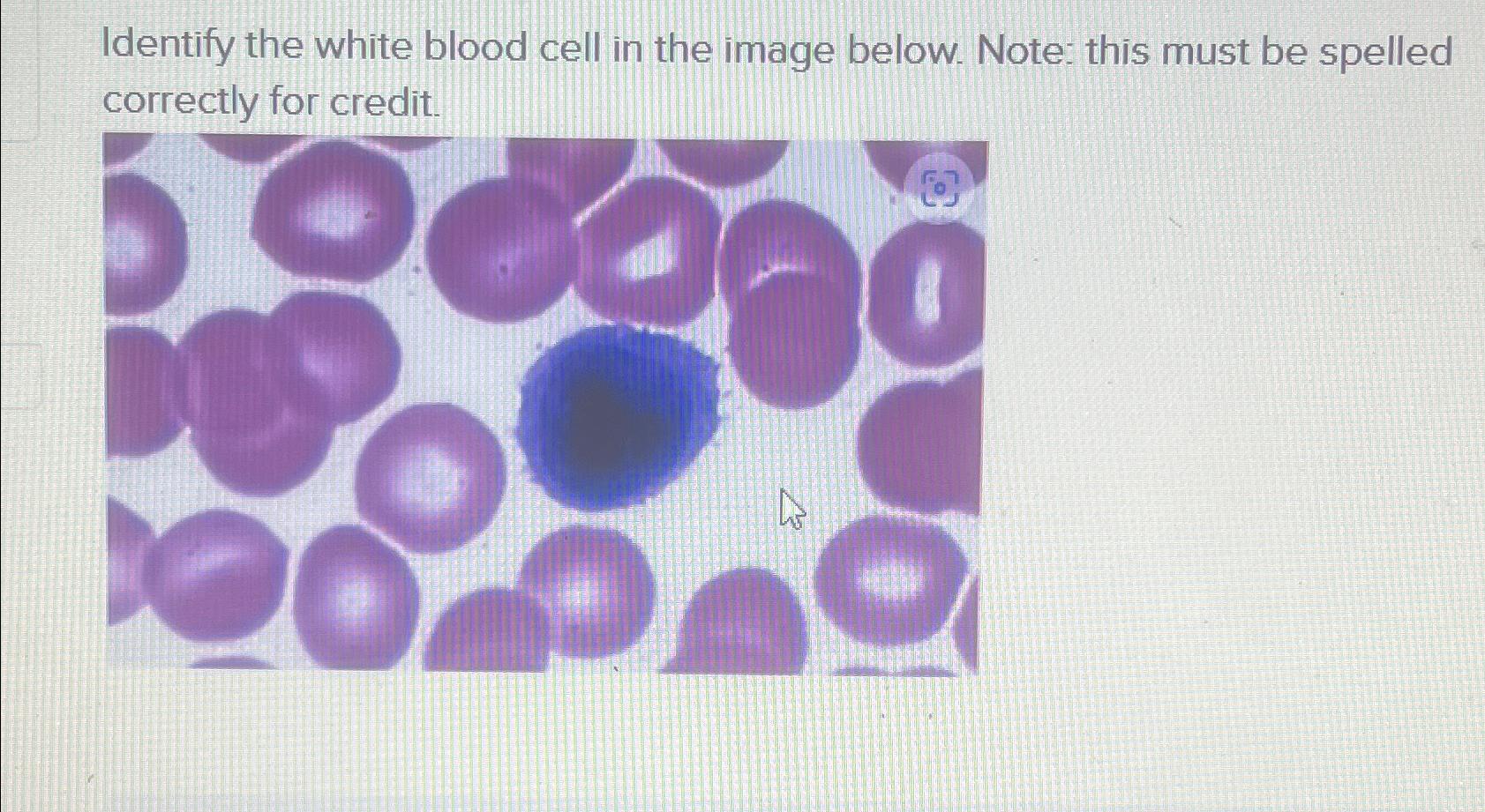 Solved Identify the white blood cell in the image below. | Chegg.com