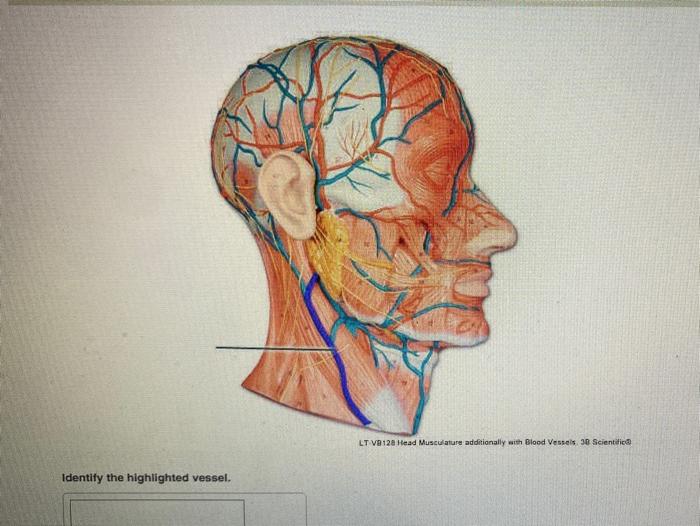 Solved LT V8128 Head Musculature additionally with Blood | Chegg.com