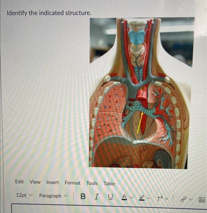 Solved Identify The Indicated Structure | Chegg.com