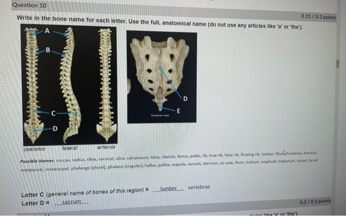 Solved Write in the bone name for each letter. Use the full, | Chegg.com