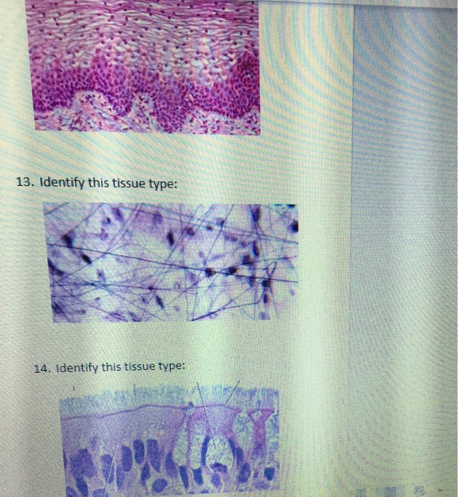 Solved 13. Identify this tissue type: 14. Identify this | Chegg.com