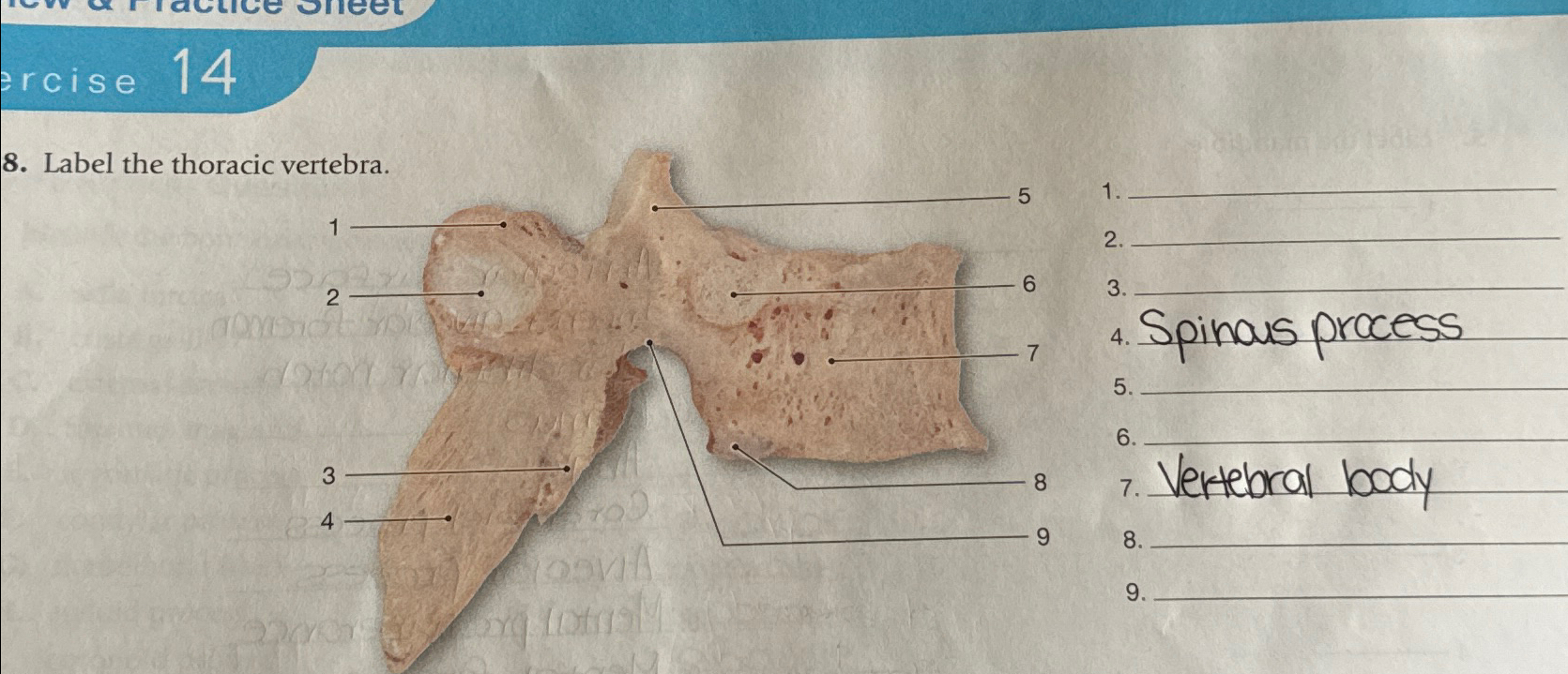 Solved rcise 148. ﻿Label the thoracic vertebra.q,2q,Spinas | Chegg.com