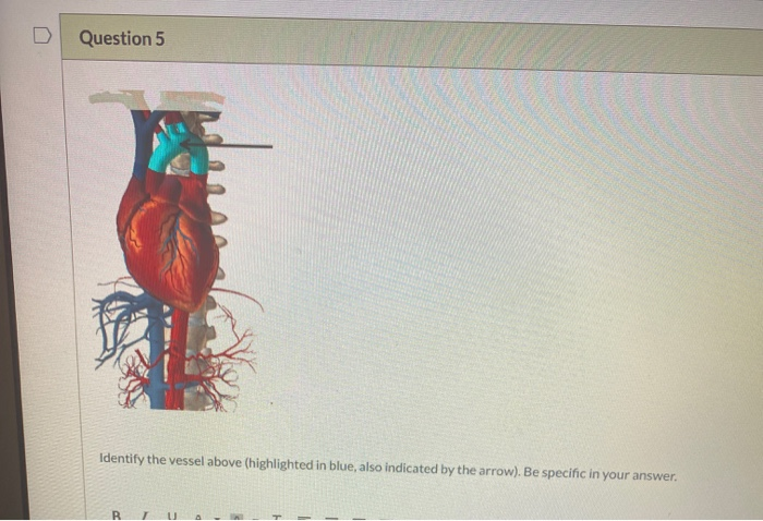 Solved Question 5 Identify The Vessel Above (highlighted In | Chegg.com