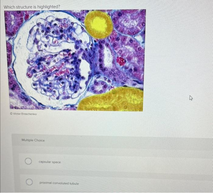 Multiple Choice
copsular space
proximal convoluted tubule