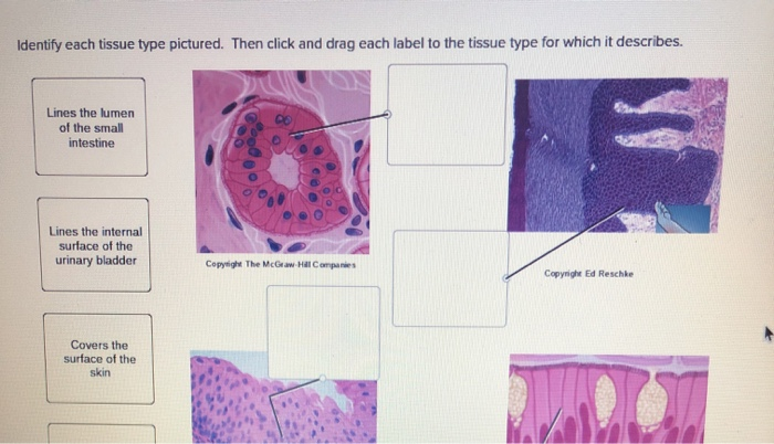 Solved Identify Each Tissue Type Pictured. Then Click And 