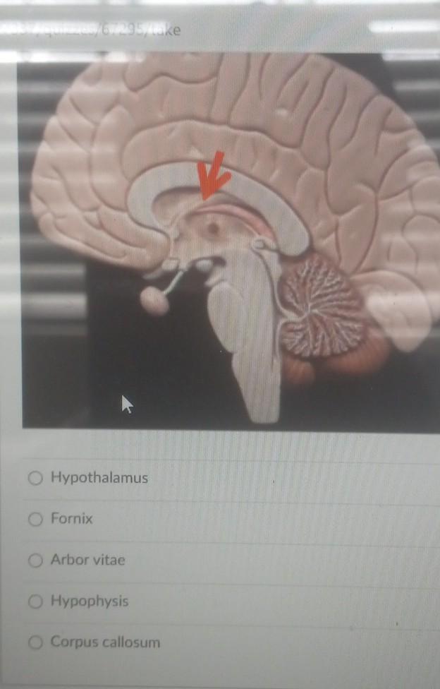 Solved 2007 veelzco) 67295/make Hypothalamus Arbor vitae | Chegg.com