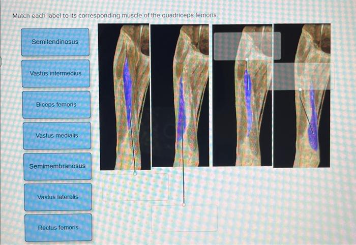 Solved Match each label to its corresponding muscle of the | Chegg.com