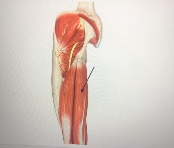 Solved identify the muscle for the parts pointed by the | Chegg.com