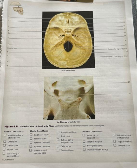 10 1 22 Figure 8.11 Superior View of the Cranial | Chegg.com