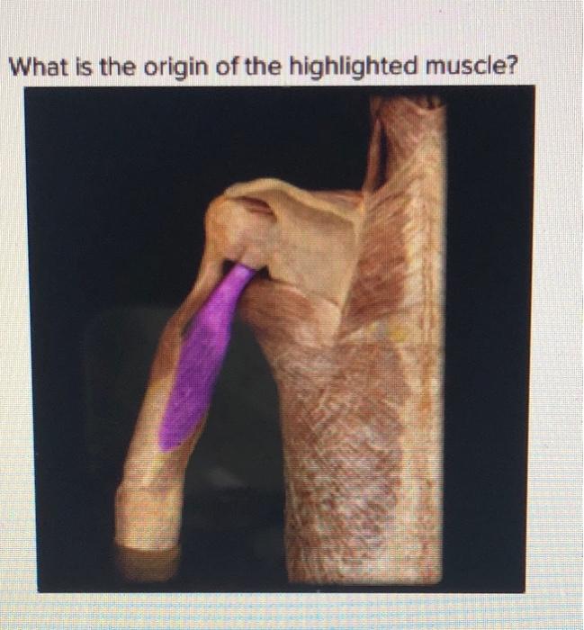 Solved What is the origin of the highlighted muscle? O | Chegg.com