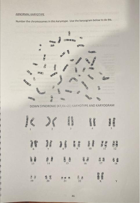 NORIMAL KARYOTYPES Number the chromosomes in this | Chegg.com