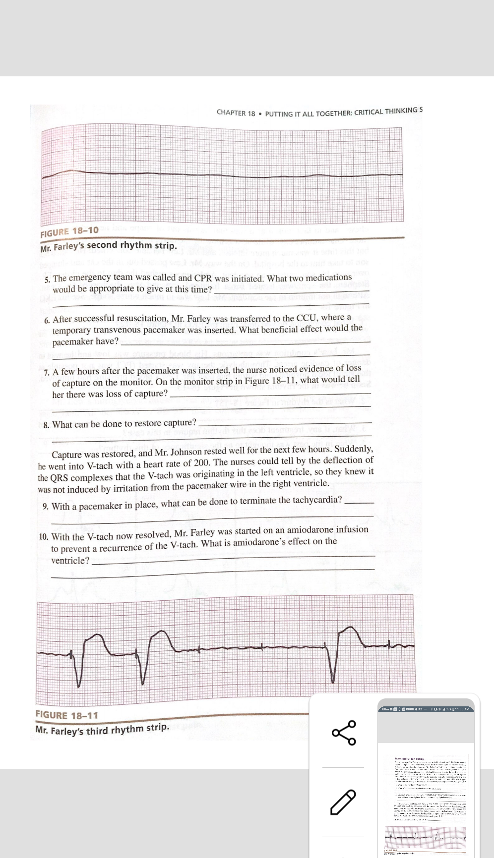 CHAPTER 18. PUTTING IT ALL TOGETHER: CRITICAL THINKINGS FIGURE 18-10 Mr. Farleys second rhythm strip. 5. The emergency team