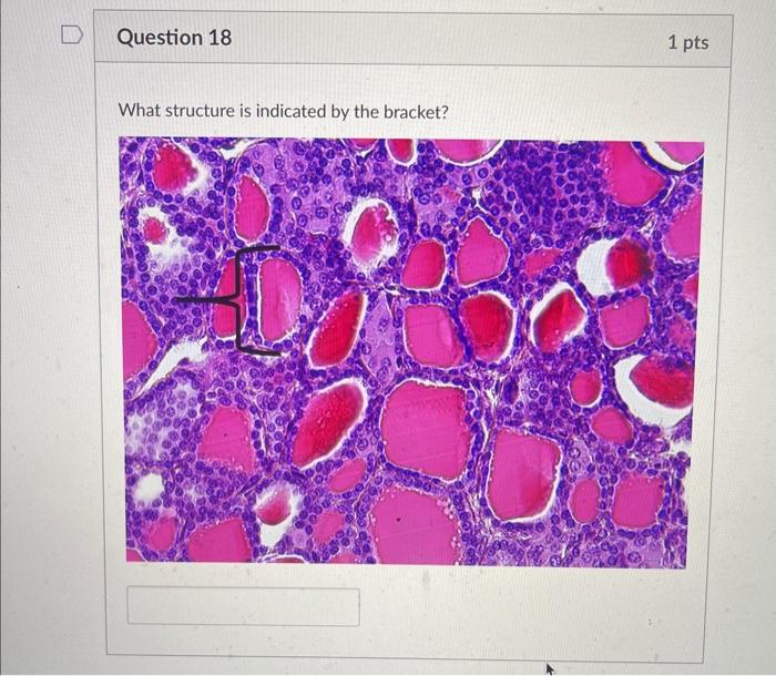 Solved What structure is indicated by the bracket?