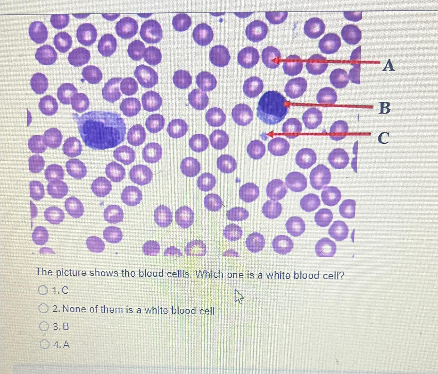 Solved The picture shows the blood cells. Which one is a | Chegg.com