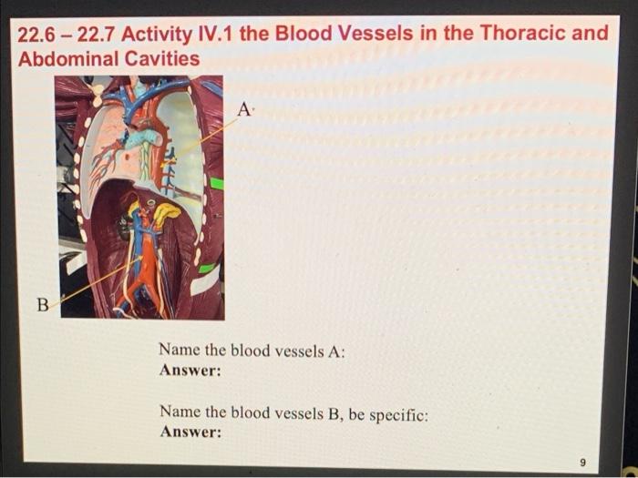 Solved 22.6 - 22.7 Activity IV.1 The Blood Vessels In The | Chegg.com