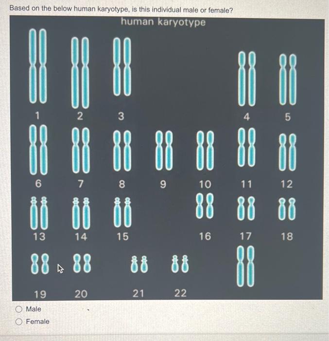 Solved Based On The Below Human Karyotype, Is This | Chegg.com