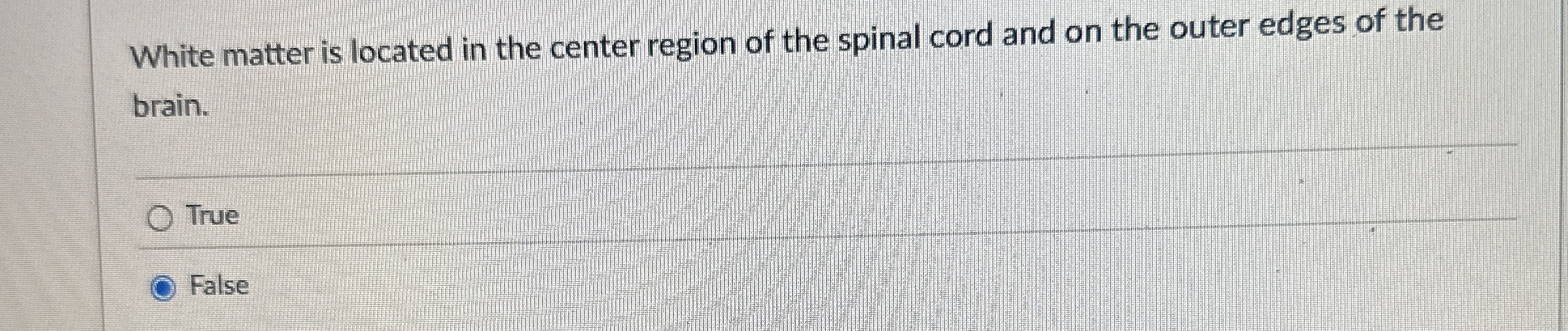 Solved White matter is located in the center region of the | Chegg.com