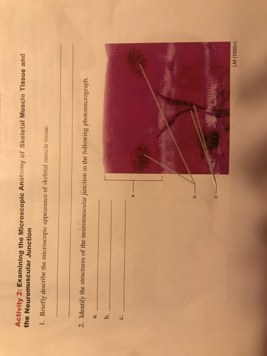 Solved 3. Match each of the following ter breach of the | Chegg.com