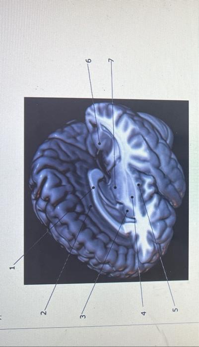 Solved Please name the brain structure indicated by numbers | Chegg.com