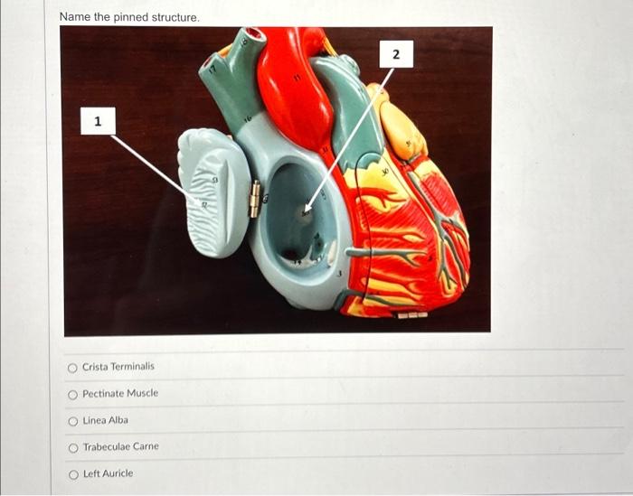 Name the pinned structure. Crista Terminalis
