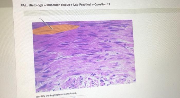 PAL: Histology > Muscular Tissue > Lab Practical > Question 12
Identify the highlighted structures.