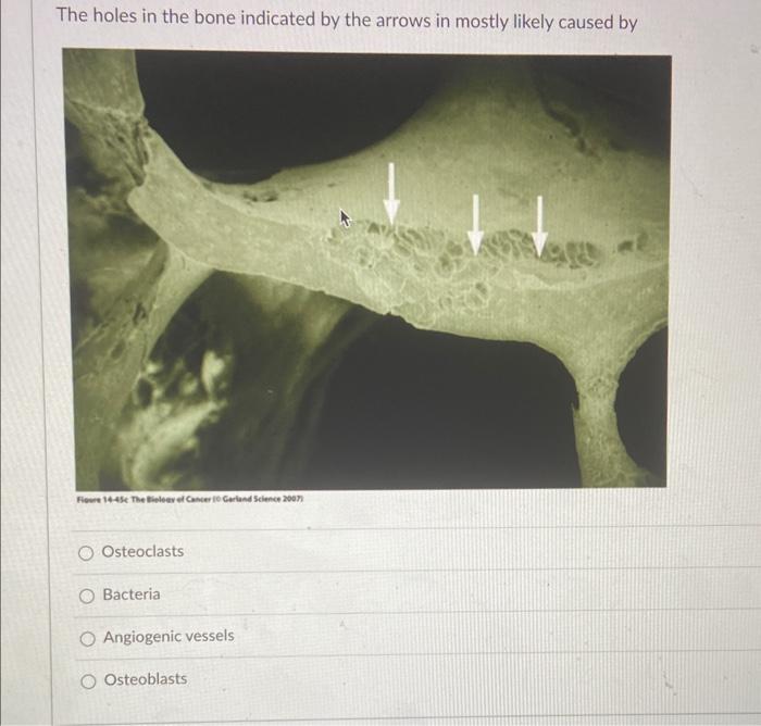 Solved The holes in the bone indicated by the arrows in