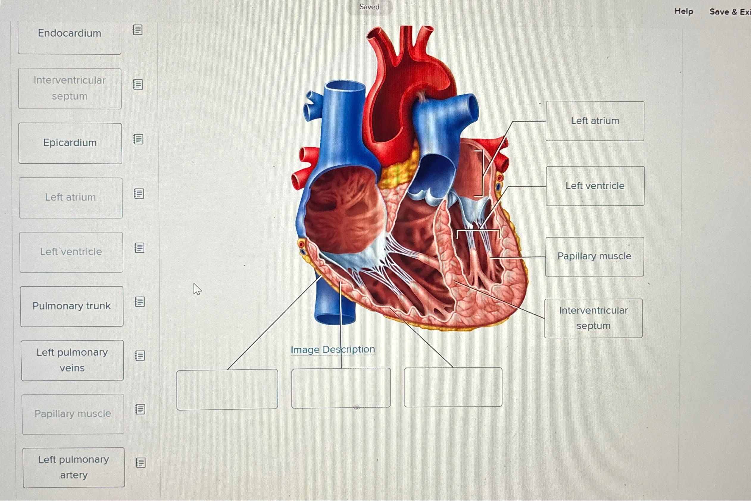 Solved Correctly label the internal anatomy of the heart. | Chegg.com