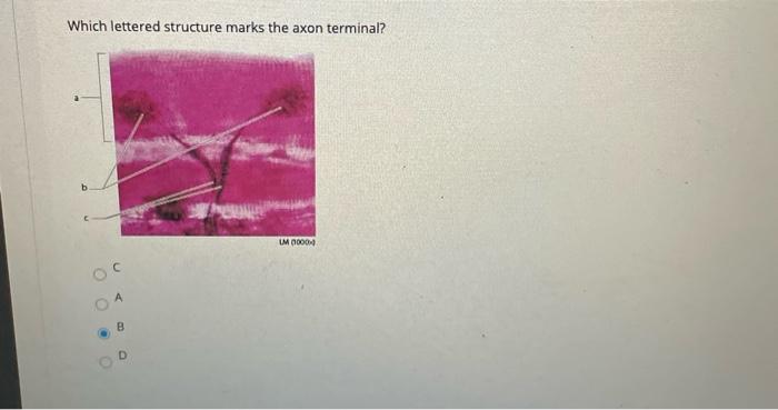 solved-which-lettered-structure-marks-the-axon-terminal-um-chegg