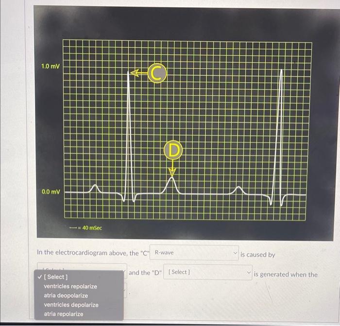 Solved In The Electrocardiogram Above, The "C" Is Caused By | Chegg.com