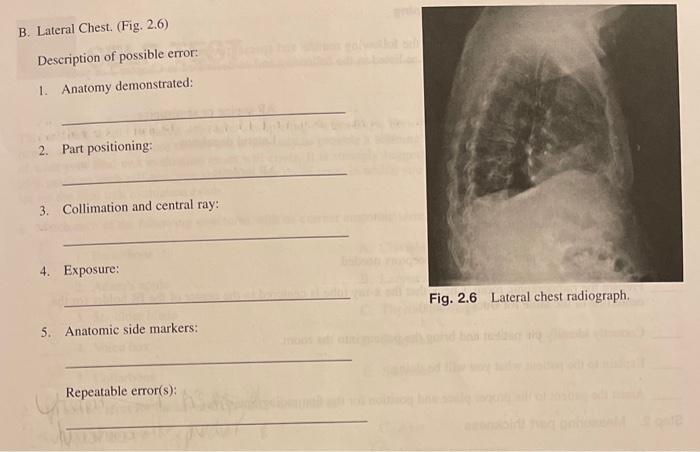Solved REVIEW EXERCISE E: Critique Radiographs of the Chest | Chegg.com