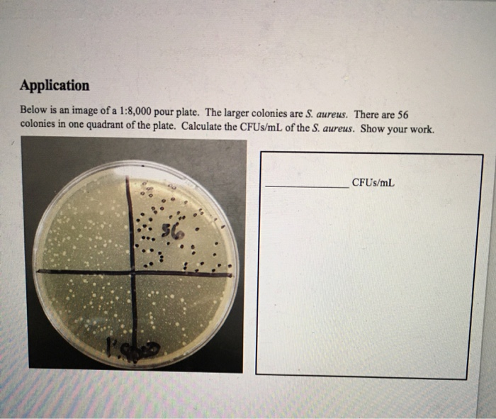 Streak Plate Results Observe the appearance of the