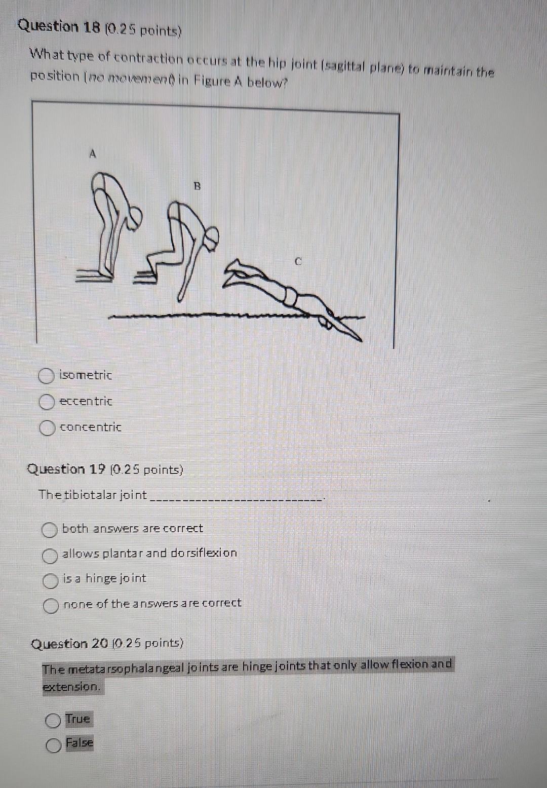 Solved What type of contraction occurs at the hip joint | Chegg.com