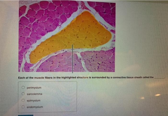 Solved Each Of The Muscle Fibers In The Highlighted Chegg Com
