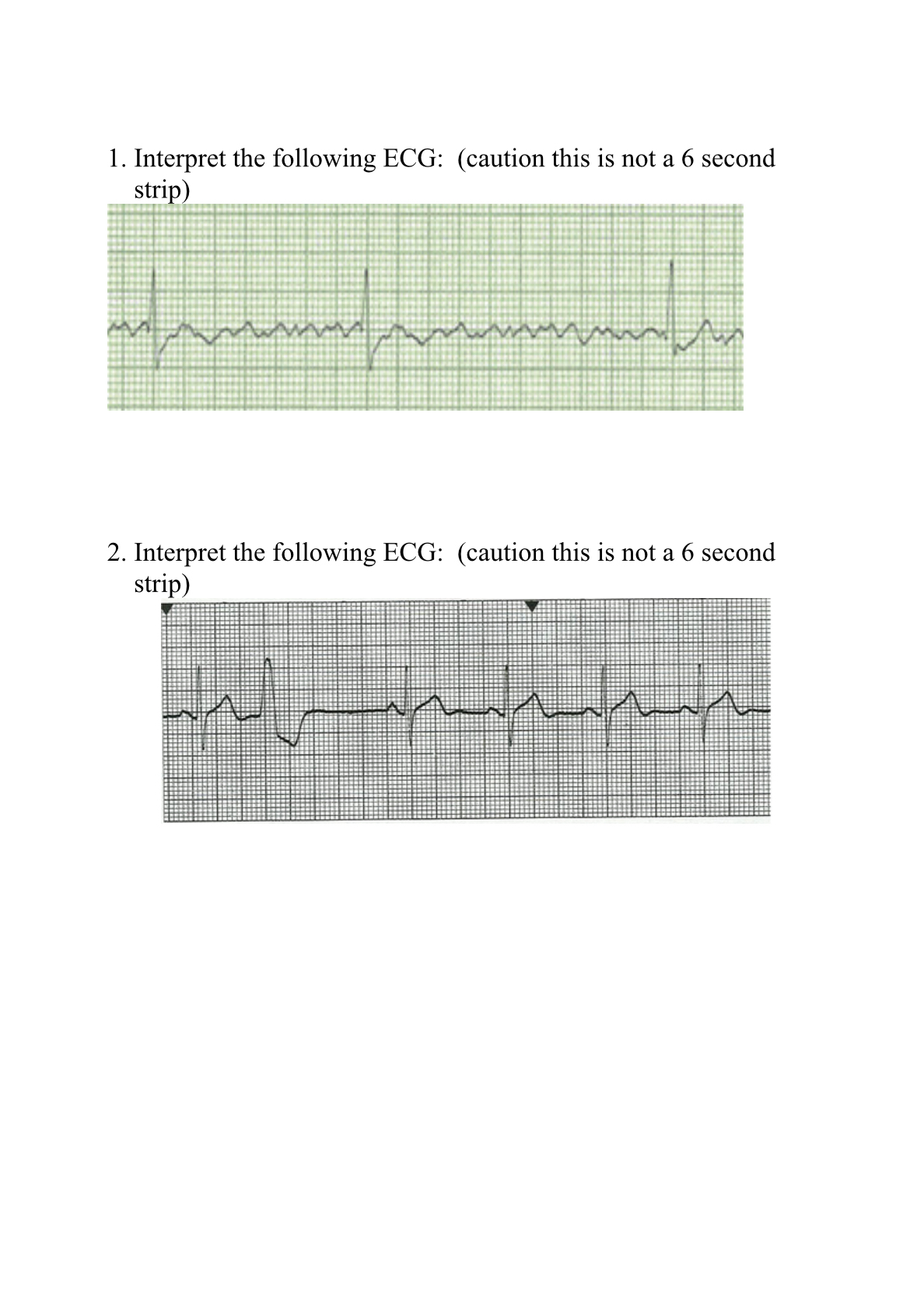 Solved Please help to interpret the following ECG rhythym | Chegg.com