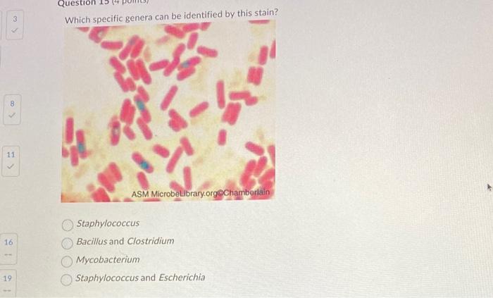 Which snecific genera can be identified by this stain?
Staphylococcus
Bacillus and Clostridium
Mycobacterium
Staphylococcus a