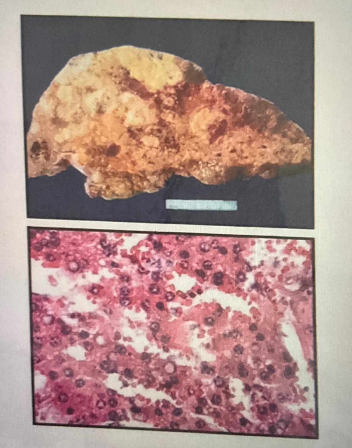 Solved What is the specimen and explain in detail . ﻿Dont