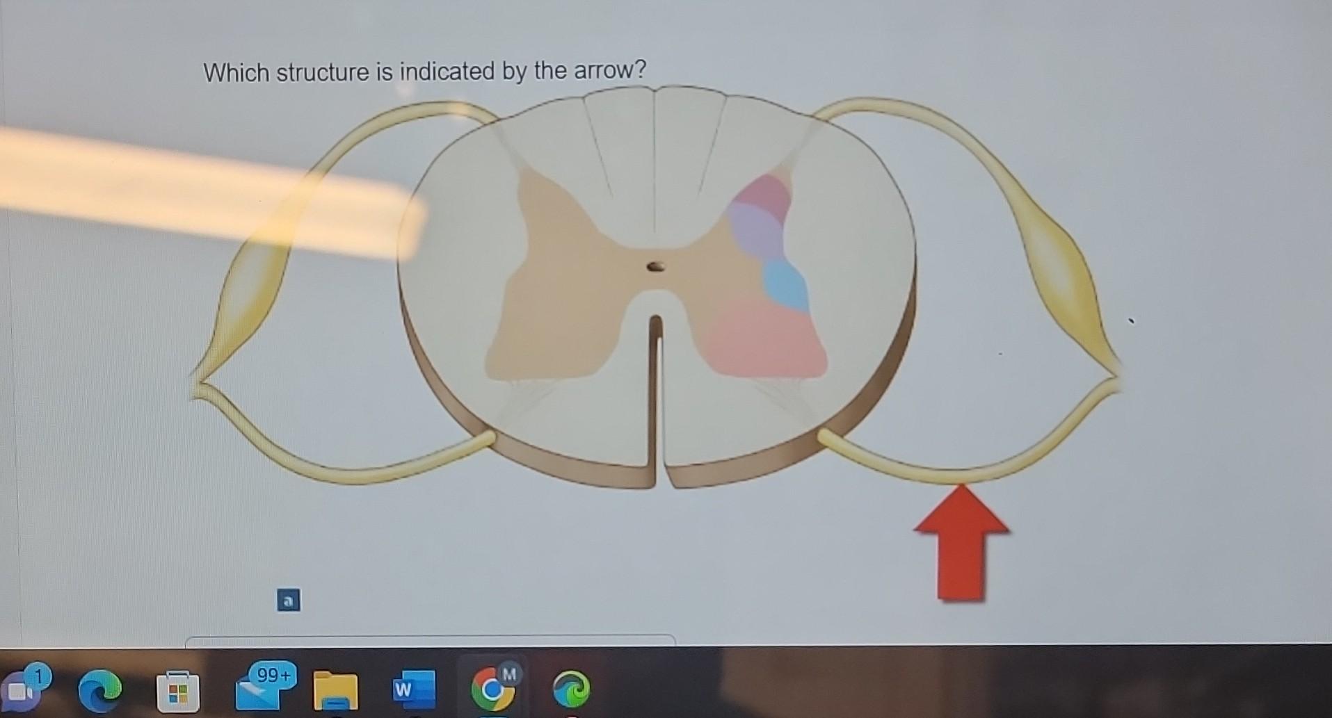Solved e maring Artbased Question The Spinal Cord Question