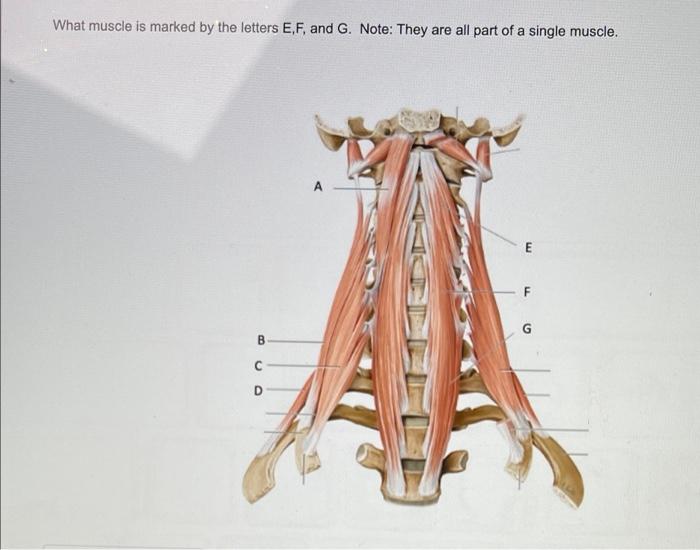 Solved What muscle is marked by the letters E, F, and G. | Chegg.com