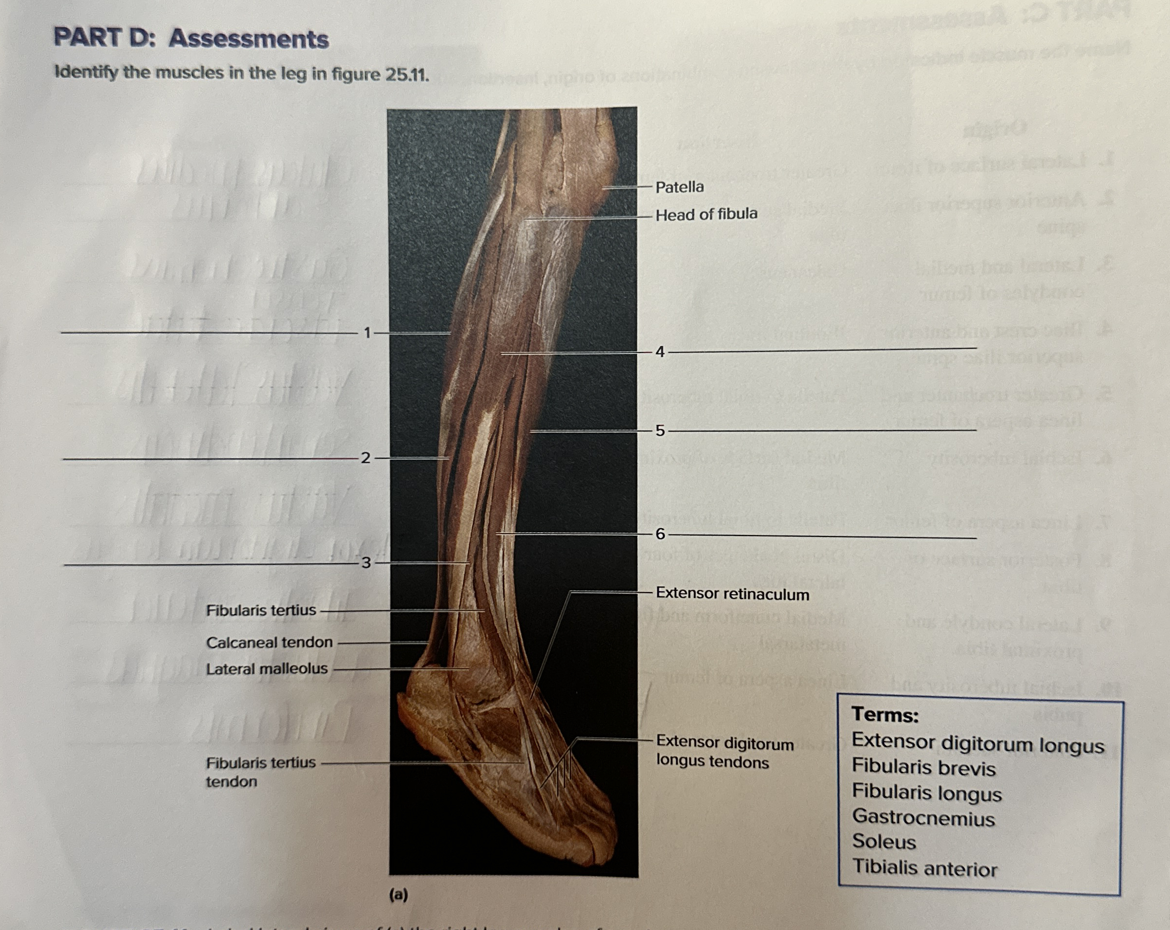 PART D AssessmentsIdentify the muscles in the leg in