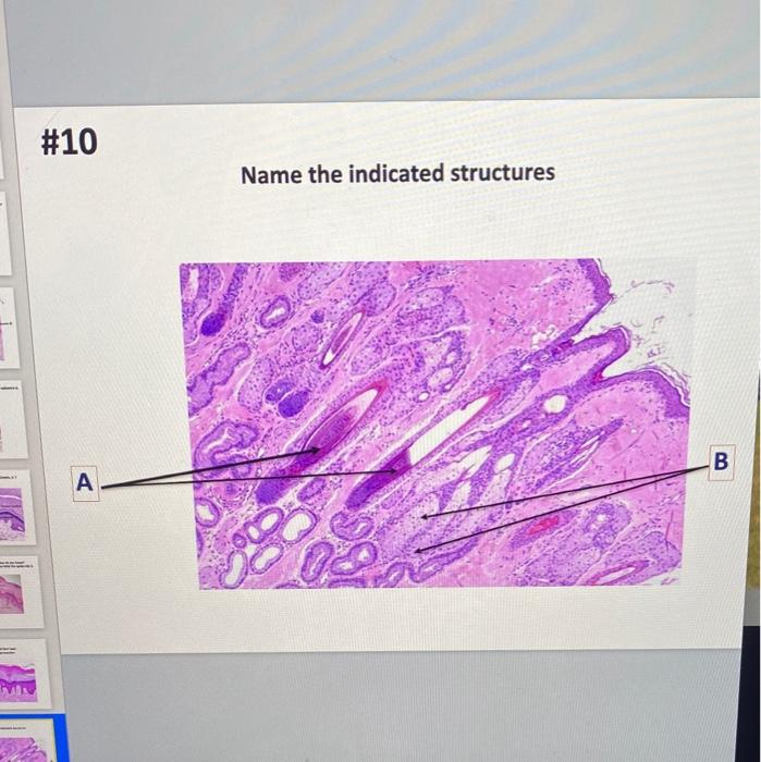 Solved #10 Name the indicated structures B D | Chegg.com