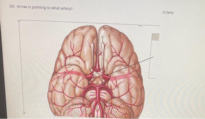 Solved Identify the major arteries branching from the aorta | Chegg.com