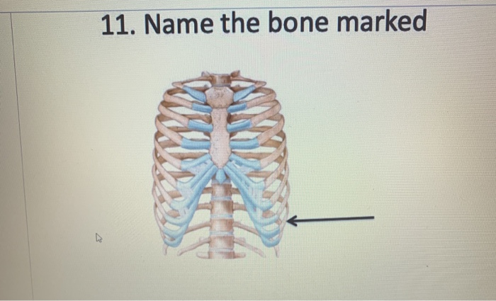 Solved 11. Name the bone marked | Chegg.com