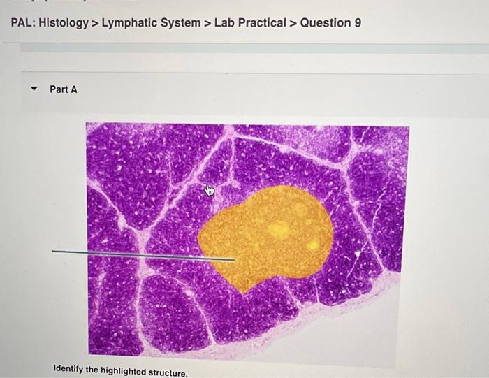 PAL: Histology > Lymphatic System > Lab Practical > | Chegg.com