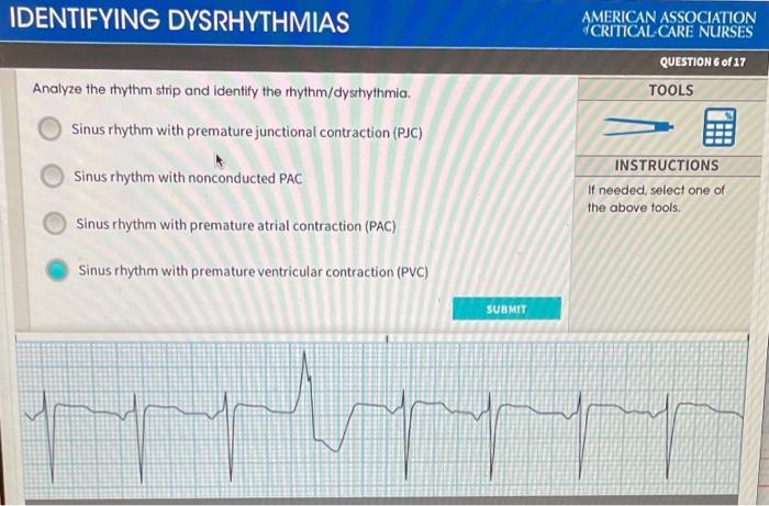 Solved Identifying Dysrhythmias American Association 