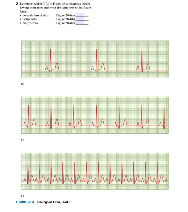 Solved 454 Read this section EXERCISE 28 CARDIAC CYCLE | Chegg.com