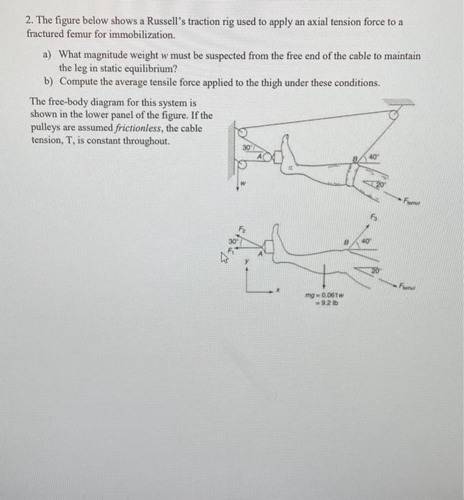 2. The figure below shows a Russells traction rig used to apply an axial tension force to a fractured femur for immobilizati