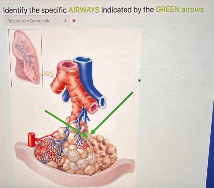 Identify the specific AIRWAY indicated in yellow | Chegg.com