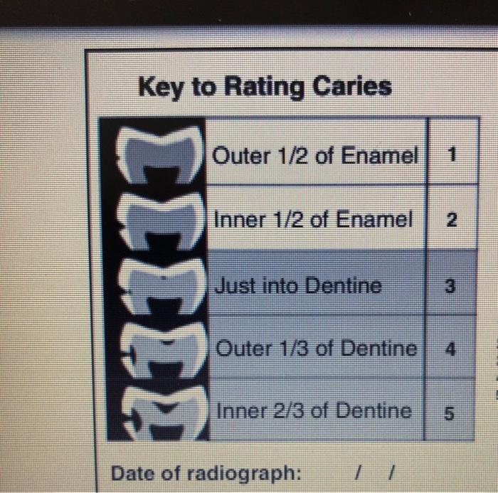 Solved please classify all the caries present in both | Chegg.com